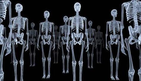 X射線成像技術儀器 X射線成像技術儀器