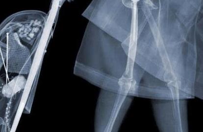 女人過安檢沒有隱私可言,安檢儀器是什么你知道嗎 女人過安檢沒有隱私可言,安檢儀器是什么你知道嗎