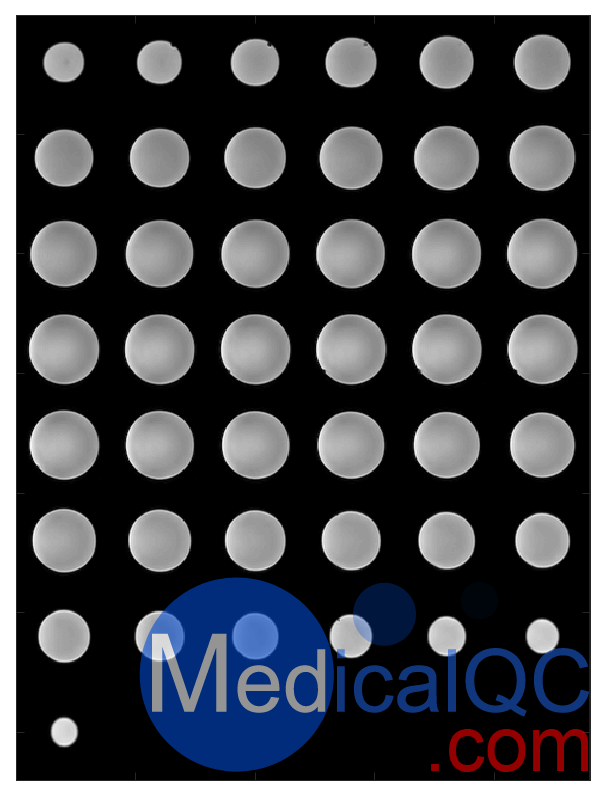 FUNSTAR球形凝膠穩定性模型，FUNSTAR fMRI穩定性模體