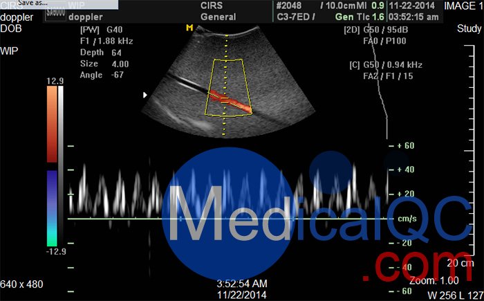 CIRS 769多普勒流量泵，CIRS 769血流測試系統