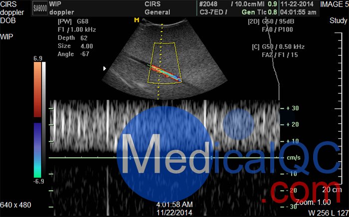 CIRS 769多普勒流量泵，CIRS 769血流測試系統