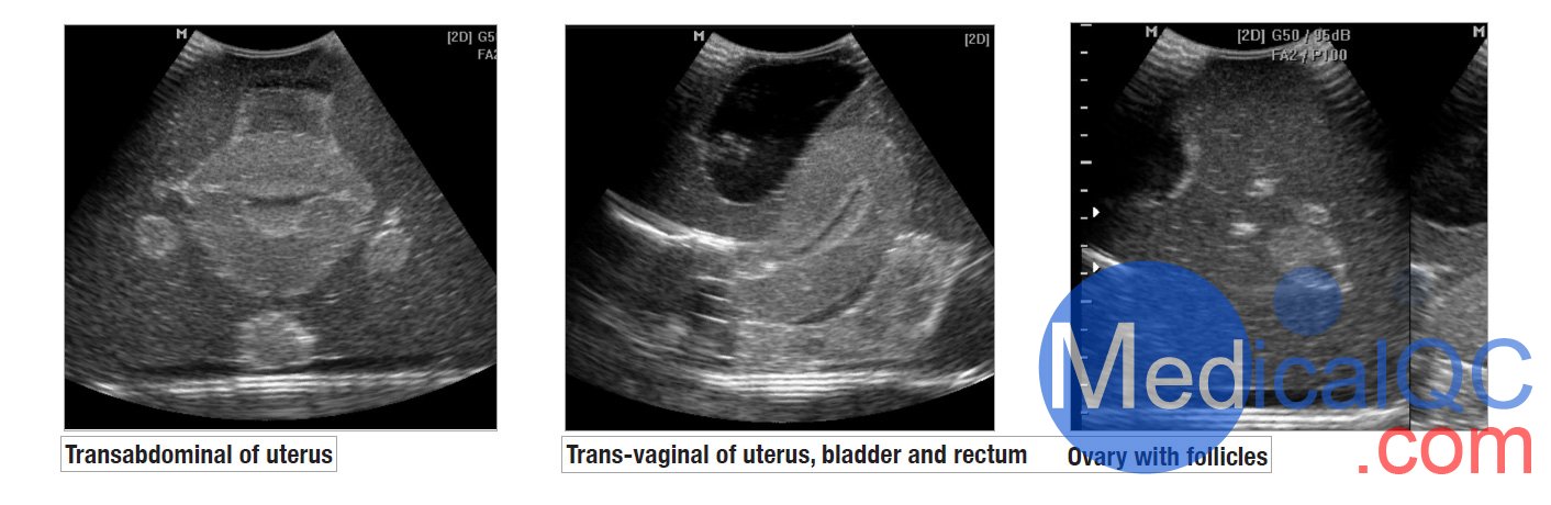 CIrs 404A女性盆腔模體，CIrs 404A超聲訓練骨盆模體影像圖