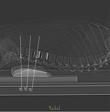 德國Erler Zimmer 7200天然骨骼全身模體，EZ 7200全身模體