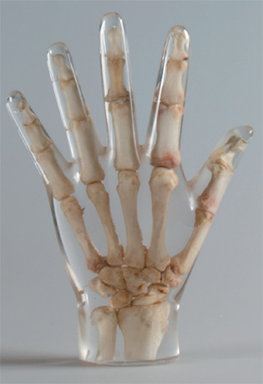 Erler Zimmer天然骨骼模體,Erler Zimmer手掌模體