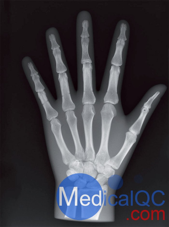 Erler Zimmer天然骨骼模體,Erler Zimmer手掌模體效果