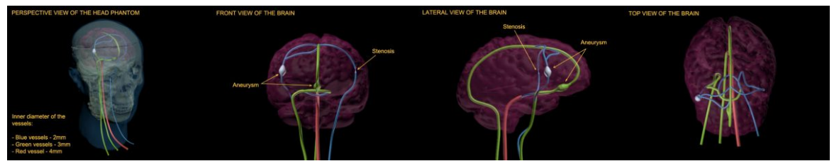 True phantom動態成人人體頭部模體影像效果
