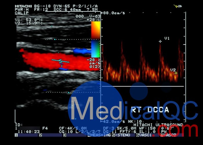 CIRS 043多普勒模體,CIRS 043 Mark 4多普勒超聲模體